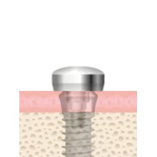 UF(II) Healing Abutment Non-Submerged