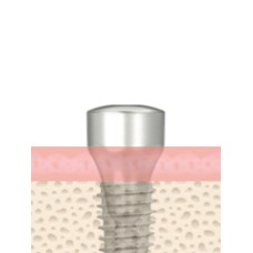 UF(II) Healing Abutment Submerged