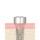 UF(II) Healing Abutment Submerged